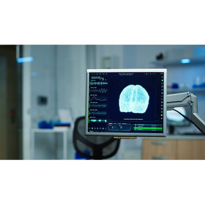 تصویر با کیفیت تصویر برداری پزشکی داخلی با دستگاه های مدرن