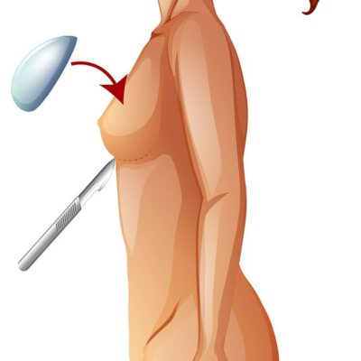 طرح وکتور آناتومی سینه با موضوع افزایش حجم پستان