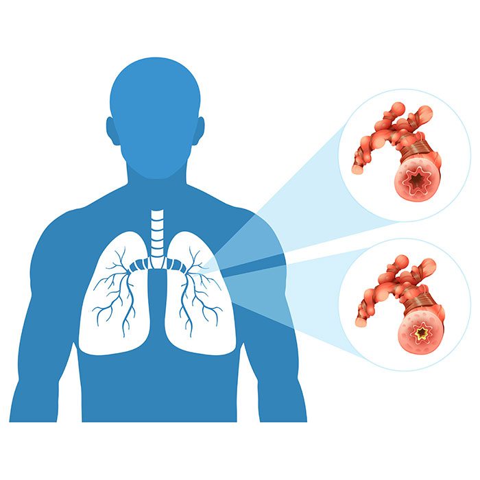 human lung white background 1 وکتور - ایمپلنت - سینه - زن