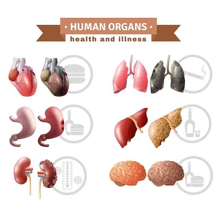 human organs heath risks medical poster 1 وکتور - ایمپلنت - سینه - زن